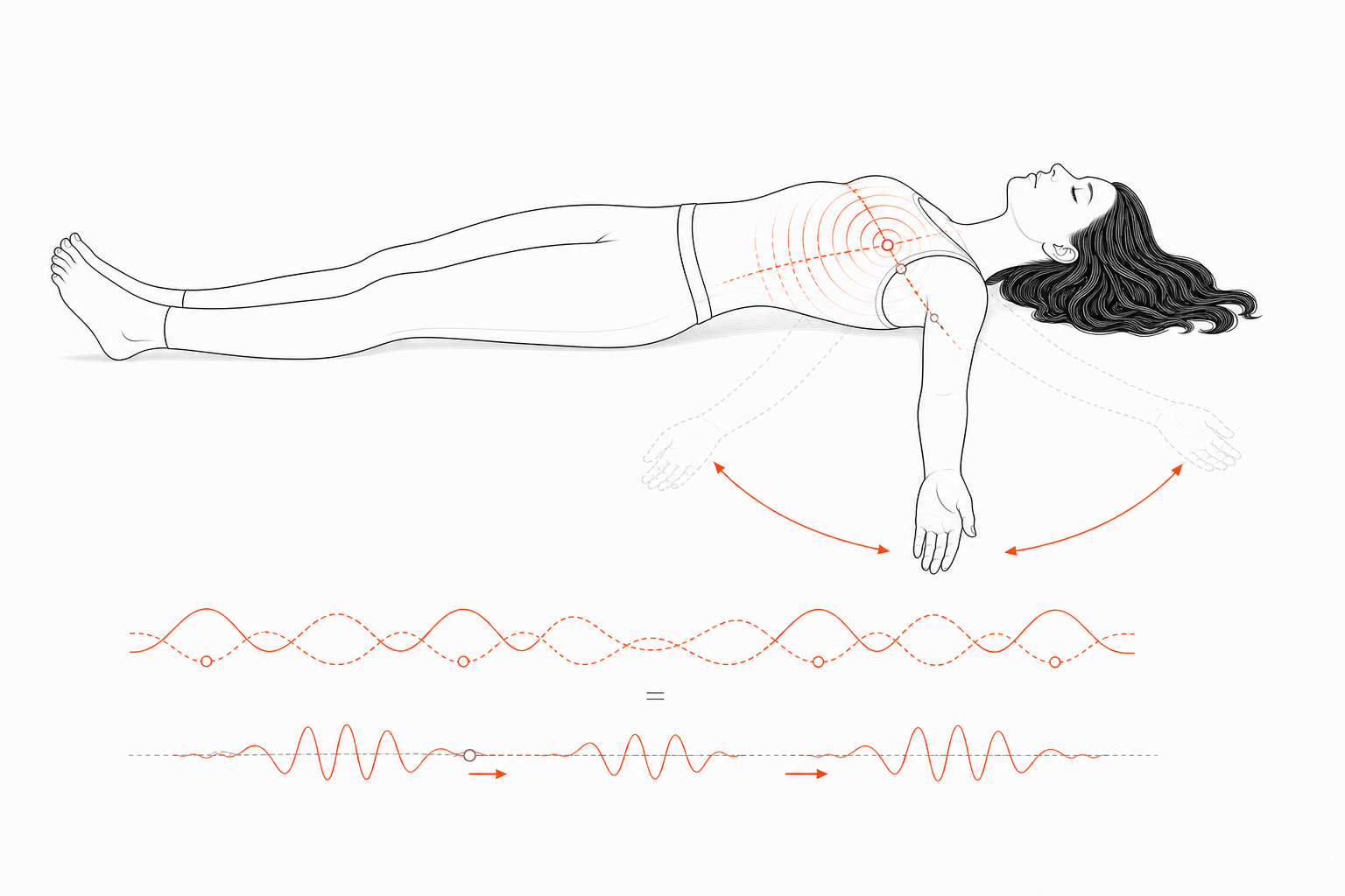 Minimal line anatomy illustration for Quadrature-Arm Sternal Node Migration.